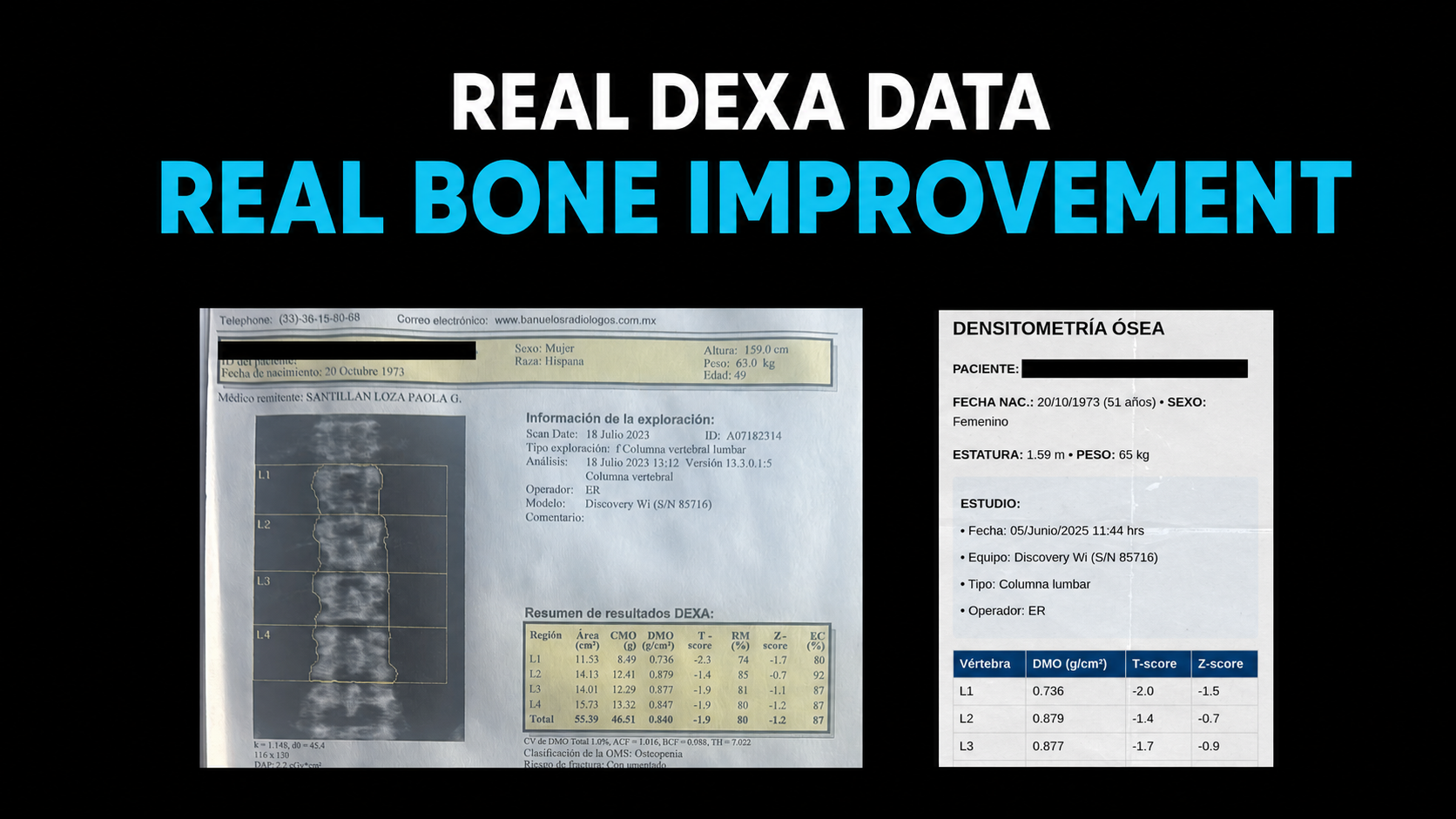 María lowered her fracture risk 16% in 22 weeks